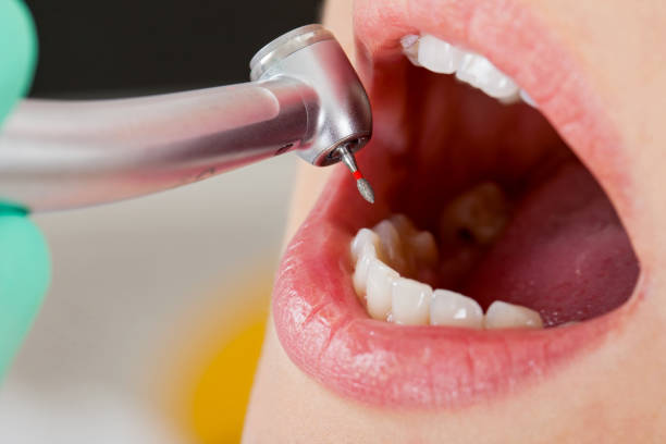 Professional Emergency Dentist in Quincy, IL